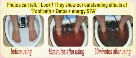 Yoga and Ion Foot Detox bath: a cure for back pain?