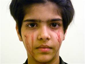 Iranian kid Singer and Miraculous Indian bleeder.