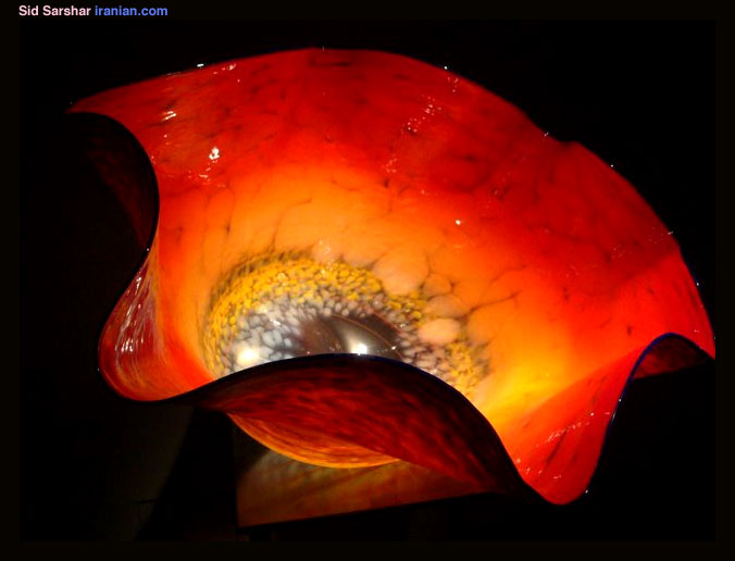 glassar023